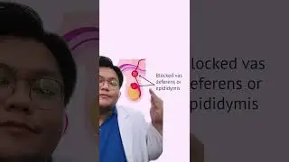 Suami Mandul Gara gara Sering Masturbasi?