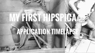 Cast No. V - my first HipSpica (Application Timelapse)