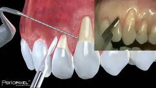 Avance vídeo completo 