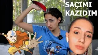 Saçımı Neden Kazıdım?