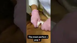 The most perfect pop💥