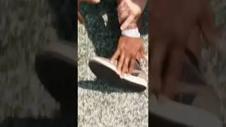 He Broke His Ankles, Then Called The Cops!