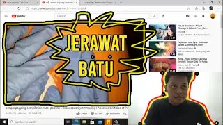 Jerawat pimple big removal satisfying [Reaction]