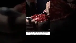 😱 100% летальный исход