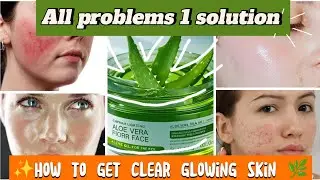 Aloe Vera Gel for Face | Clear Skin, Acne Cure & Natural Glow 🌿