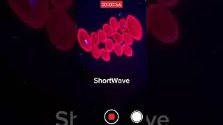 Synthetic & Natural Rubies UV Reactions