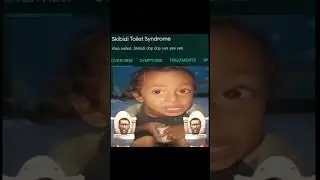 Skibidi toilet syndrome