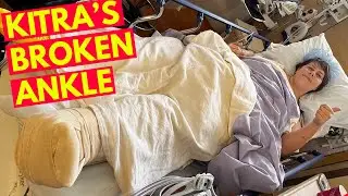 Broken Ankle On A Cruise!