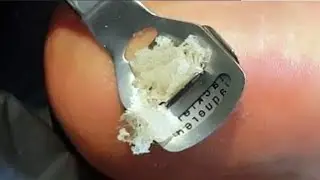 Pedicure Done By a Pedicurist