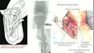 Knee dislocations - Panel case discussion