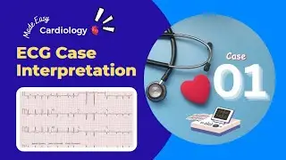Abnormality in ECG Graph | Discussion about ECG Cases || ECG Cases for Students