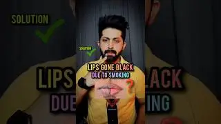 Solution For Black Lips Due To Smoking 🚬👄 