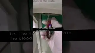 Doing complete blood count in Sysmex 3 part Hematology Analyzer 