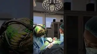 Ear Keloid Removal Surgery! 