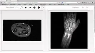 dicom-viewer-4