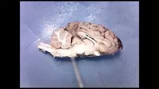 Sheep Brain Midsagittal View