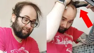 BALDING MAN First Time SHAVING HEAD BALD *15 Year Balding Journey*