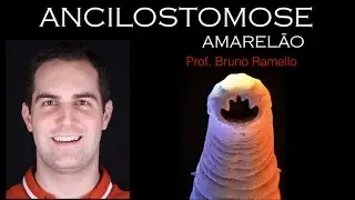 Verminoses - Ancilostomose ou Amarelão