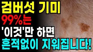 집에서 검버섯, 기미 없애는 방법 4가지 총정리! 피부과에 비싼돈 쓰지 마세요! 검버섯, 기미, 검은 잡티 지우고 하얘지는 팩. 검버섯 예방 최고의 음식 4가지.