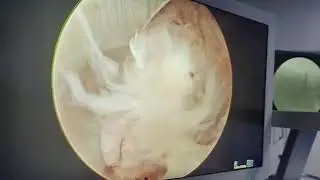 Cutting-Edge Spine Surgery in Action