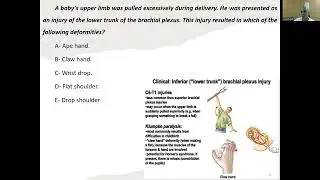MCQ Nerves of the upper limb (3)
