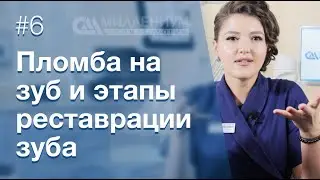 Пломба на зуб и этапы реставрации зуба