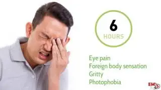UV keratitis