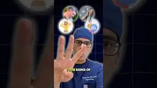 4 Signs of Magnesium Deficiency You Should Never Ignore ❌ Doctor Sethi