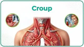 Acute Laryngotracheobronchitis (Croup) 🗣️:  ENT Lectures