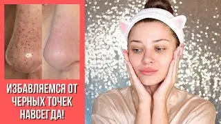 КАК НАВСЕГДА ИЗБАВИТЬСЯ ОТ ЧЁРНЫХ ТОЧЕК НА НОСУ! | ЭФФЕКТИВНЫЕ МЕТОДЫ