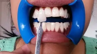 Tutorial Gimp Blanqueamiento dental