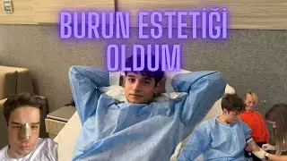 BURUN ESTETİĞİ OLDUM!