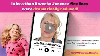 In less than 6 weeks Janene's fine lines were dramatically r﻿educed!