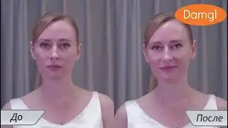 Аппарат ультразвуковой чистки лица Damgl-09/ Ультразвуковой скраббер лица/Ультразвуковая чистка лица