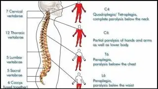 Acute Spinal Cord Injury