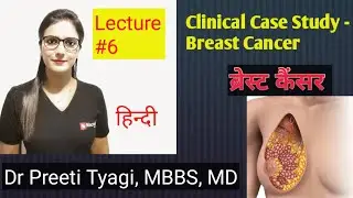 CLINICAL CASE STUDY OF BREAST ANATOMY
