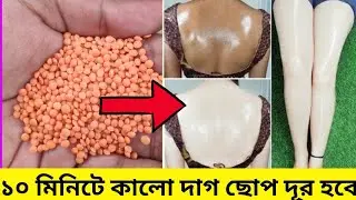 মুসুর ডাল দিয়ে শরীরের কালো দাগ ছোপ দূর করে মাত্র ১০ মিনিটে ফর্সা করার উপায়/কালো ত্বক ফর্সা/Glow Skin
