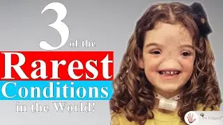 Is The First Condition Even Real?! 😨 ~ Body Bizarre!