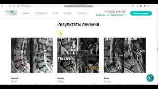 Украли снимки МРТ. Нечестная клиника в России.