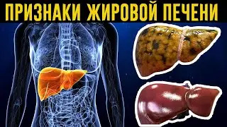 Накопление ЖИРОВ В ПЕЧЕНИ! Мне помогли эти методы и продукты для ОЧИЩЕНИЯ ПЕЧЕНИ от ЖИРОВ!
