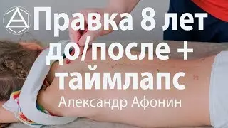 Children's manual therapy at 8 years old in Moscow: before / after + time lapse | Alexander Afonin