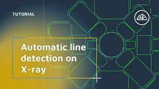 Automatic Line Detection on X-ray Views | Official 3Dsurvey Scan module Tutorial