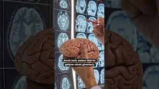 Artık zihin okumak mümkün 🧠