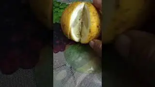কিডনি স্টোন ও গলব্লাডার স্টোন নির্ণয়ের সহজ উপায়
