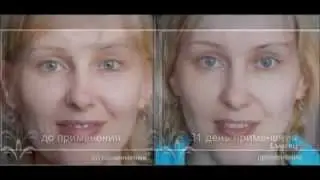 Результаты   фото Jeunesse Global Отзывы косметика Люминес