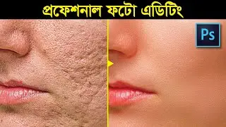 Awesome Skin Smoothing and Skin Retouching Techniques In Photoshop | Best Photoshop Editing