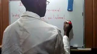 SIGMA AND PI BONDS OF BENZENE