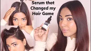 This Advanced hair growth serum helped me with my hair regrowth.