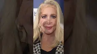RHOC's Shannon Beador Charged with DUI and Hit and Run🚔