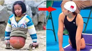 Girl with no legs didn’t complain about her fate, but followed her dream, and she surprised everyone